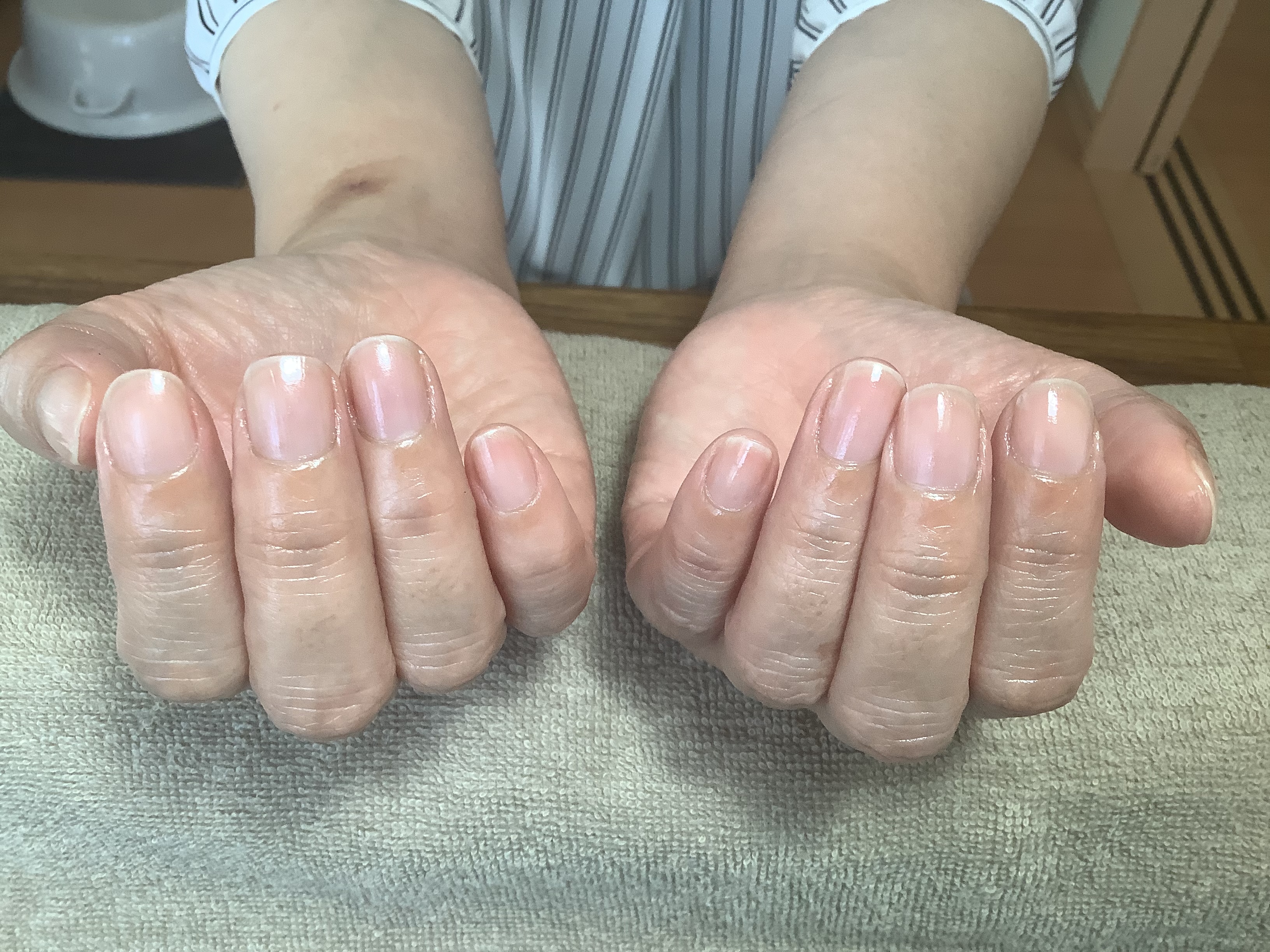 トップ つめでお悩みのサロン 高知市つめのお手入れ専門joy Joy